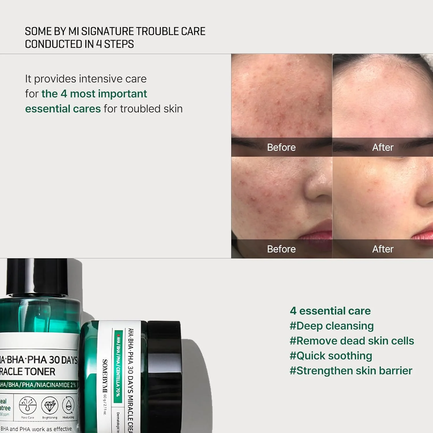 AHA.BHA.PHA 30 Days Miracle Starter Kit - Image 5