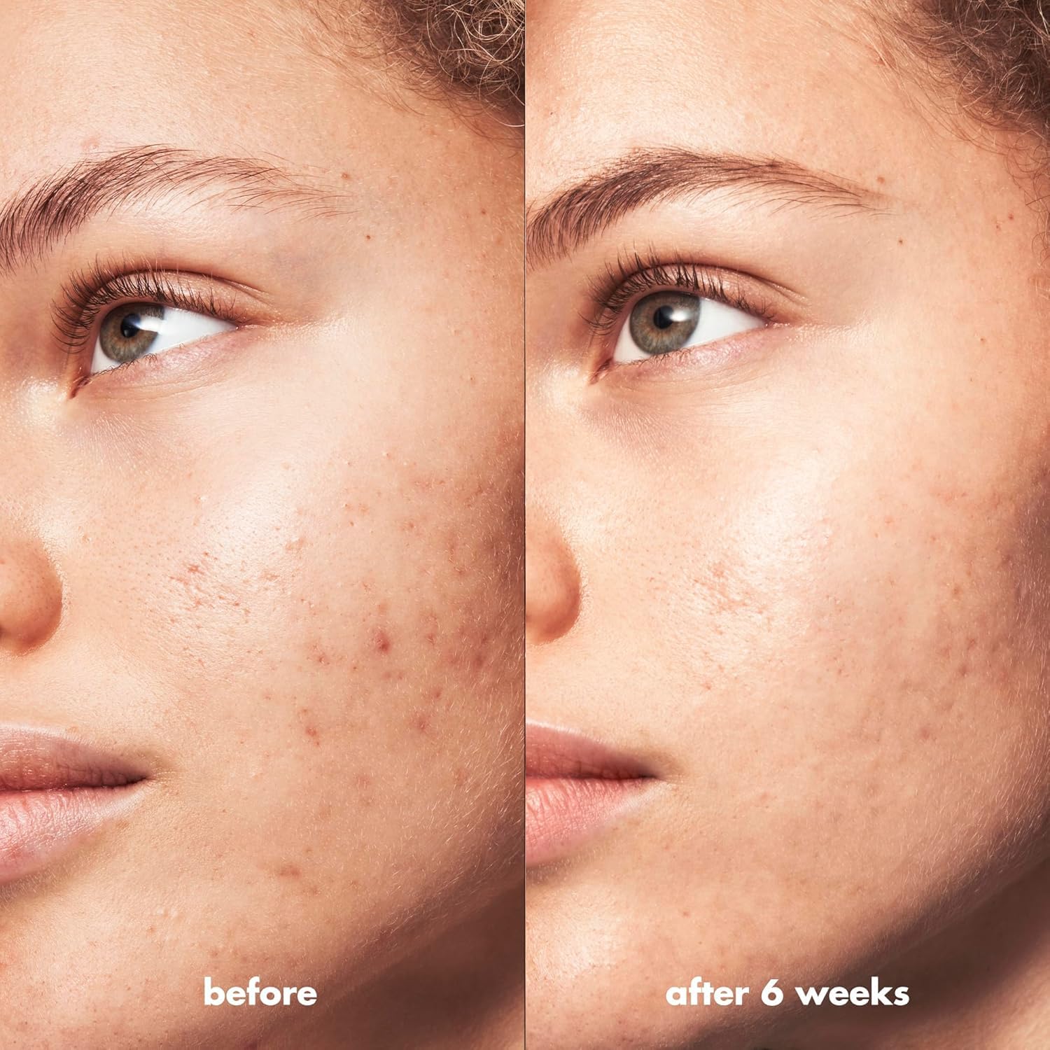 e.l.f. SKIN Blemish Breakthrough - 50ml Crema calmante y ligera, que combate las imperfecciones - Image 4