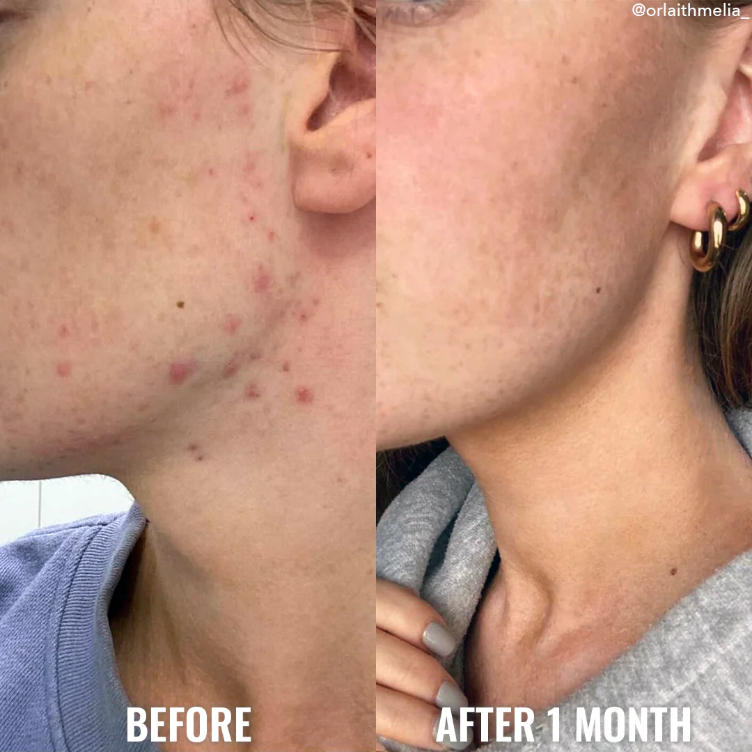 Good Molecules Serum Niacinamida- Texture & Pores - Image 4