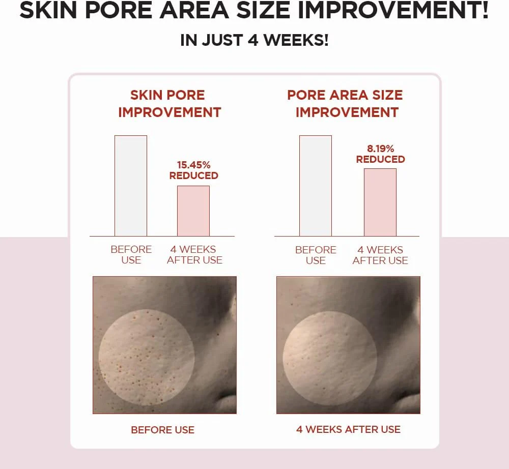 Skin1004 Centella Poremizing Tónico exfoliante y regulador del sebo 210ml - Image 7